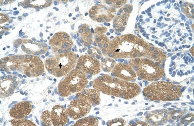 Anti-FOXP2 antibody produced in rabbit