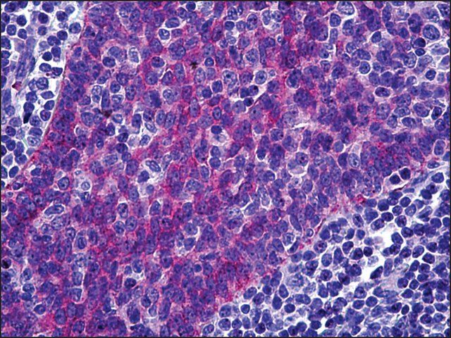 Anti-FREM1 antibody produced in rabbit