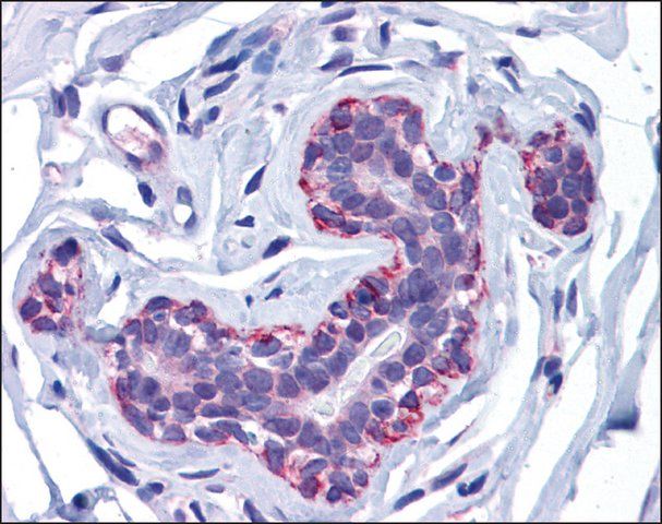 Anti-FREM2 antibody produced in rabbit