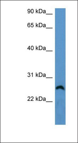 Anti-FRG1 antibody produced in rabbit