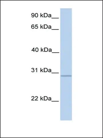 Anti-GALNT10 antibody produced in rabbit
