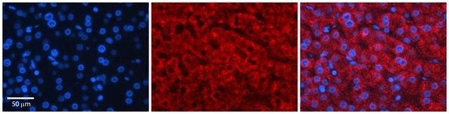 Anti-GAMT antibody produced in rabbit