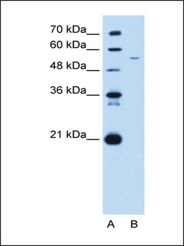 Anti-GAS7 (AB2) antibody produced in rabbit