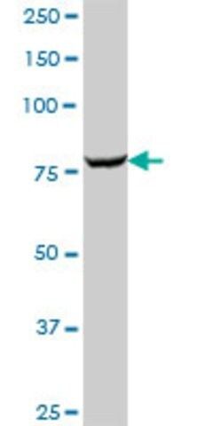 Anti-GARS, (N-terminal) antibody produced in mouse