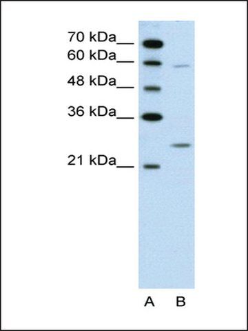 Anti-GAMT antibody produced in rabbit