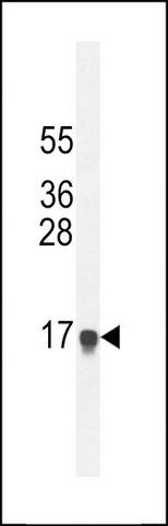 ANTI-HEPN1 (N-TERM) antibody produced in rabbit