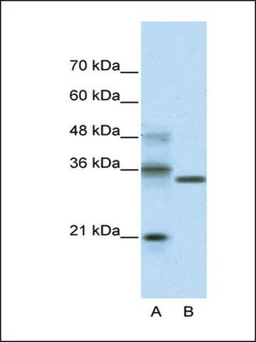 Anti-HES4 (AB1) antibody produced in rabbit