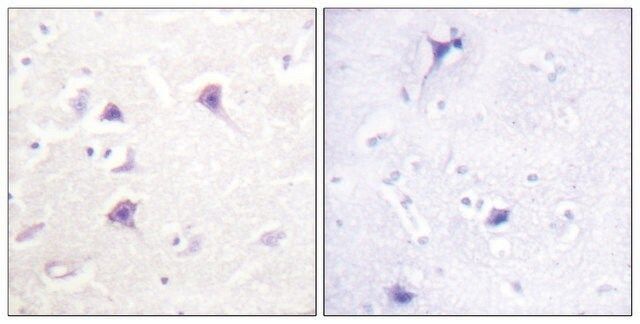 Anti-HER4 antibody produced in rabbit