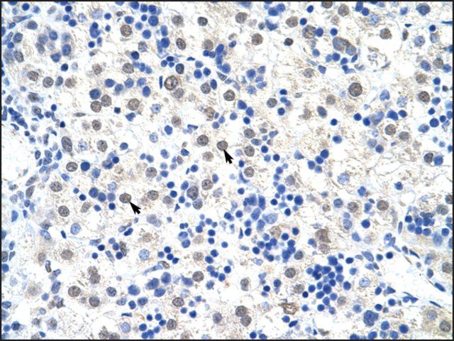 Anti-DDX47 (AB2) antibody produced in rabbit