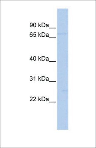 Anti-DDX59 antibody produced in rabbit