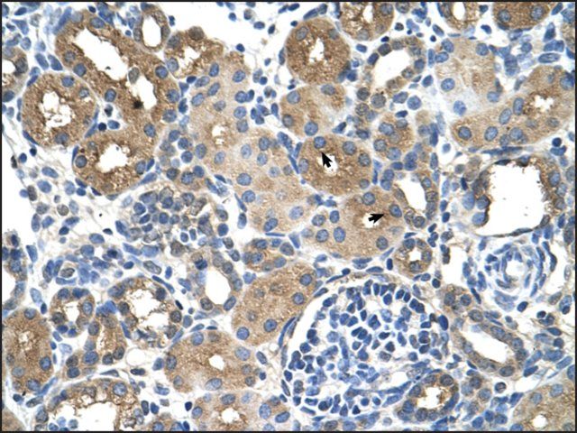 Anti-DCXR antibody produced in rabbit