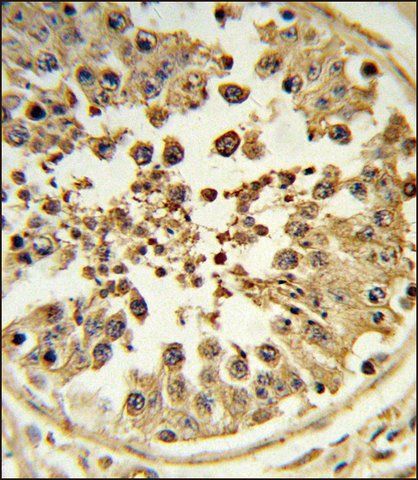 ANTI-DIAPH2 (CENTER) antibody produced in rabbit