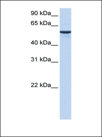 Anti-DPH2 antibody produced in rabbit