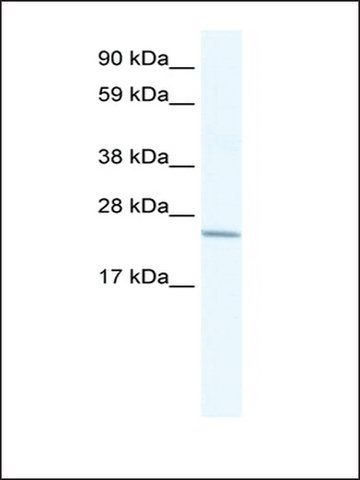 Anti-CRIP2 antibody produced in rabbit