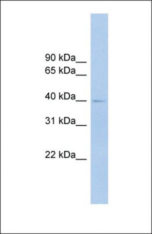 Anti-FCRLA antibody produced in rabbit
