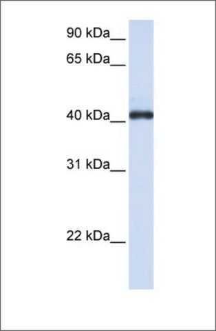 Anti-FCRLA antibody produced in rabbit