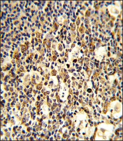 ANTI-FCGR1B (C-TERM) antibody produced in rabbit
