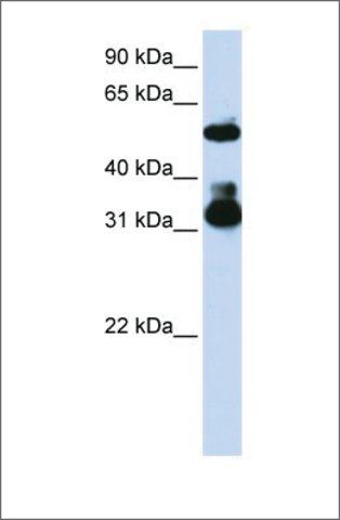 Anti-FBXW2 antibody produced in rabbit