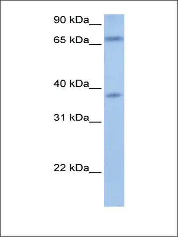 Anti-FEM1B (AB1) antibody produced in rabbit