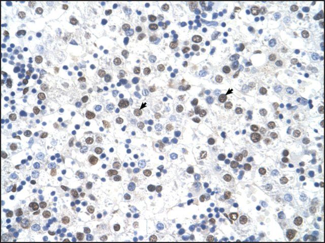 Anti-FECH (AB1) antibody produced in rabbit