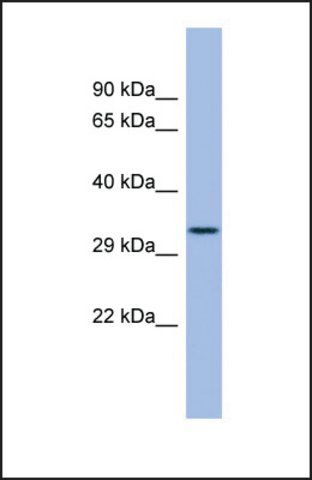 Anti-FCN3, (N-terminal) antibody produced in rabbit