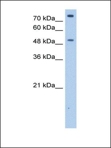 Anti-FCRL1 antibody produced in rabbit