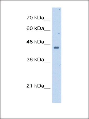 Anti-FDFT1 antibody produced in rabbit