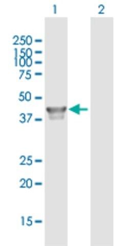 Anti-FDPS antibody produced in mouse
