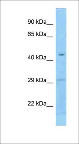 Anti-FCRLB antibody produced in rabbit