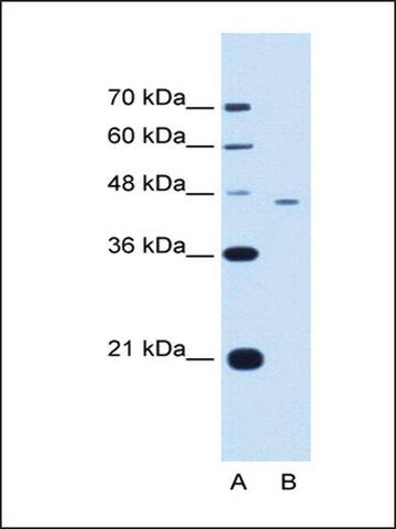 Anti-FEN1 antibody produced in rabbit