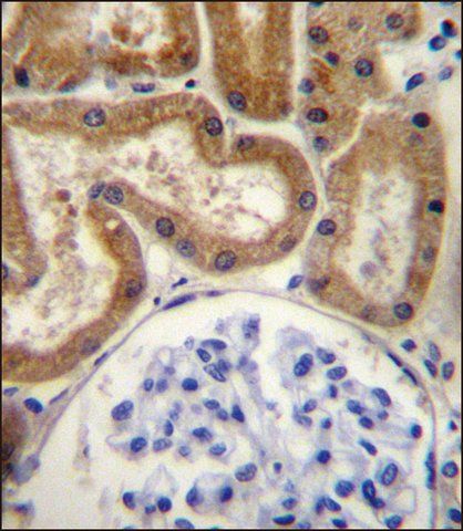 ANTI-FGD2 (C-TERM) antibody produced in rabbit