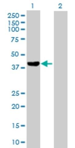 Anti-FGD6 antibody produced in mouse