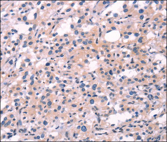 Anti-FGF16 antibody produced in rabbit