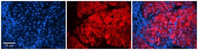 Anti-FGFR1OP (AB2) antibody produced in rabbit