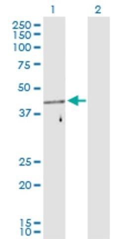 Anti-Fez1 antibody produced in rabbit