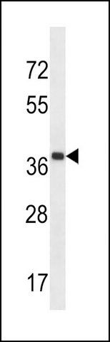 ANTI-CLIP4 (CENTER) antibody produced in rabbit