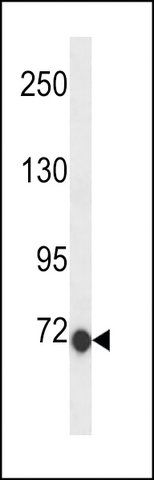 ANTI-CLIC6 (C-TERM) antibody produced in rabbit