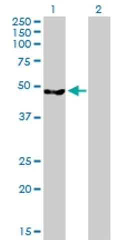 Anti-CLP1 antibody produced in mouse