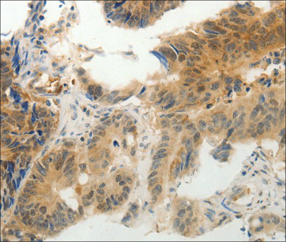 Anti-CMTM7 antibody produced in rabbit