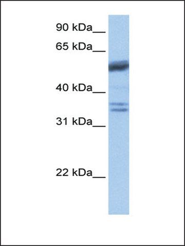 Anti-COIL antibody produced in rabbit