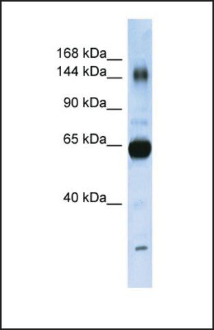 Anti-COL11A2, (N-terminal) antibody produced in rabbit