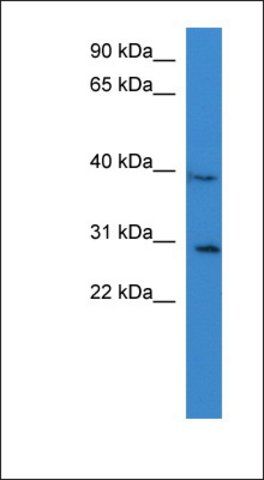 Anti-COLQ antibody produced in rabbit