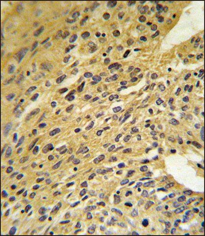 ANTI-COQ5 (CENTER) antibody produced in rabbit