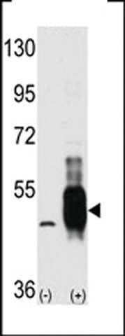 ANTI-COT (MAP3K8/MEKK8)(C-TERMINAL) antibody produced in rabbit