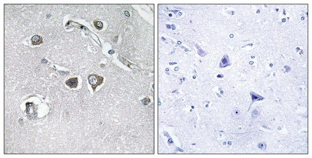 Anti-Collagen XI α2 antibody produced in rabbit