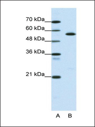 Anti-CORO1A antibody produced in rabbit