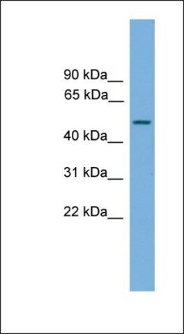 Anti-CPA6 antibody produced in rabbit