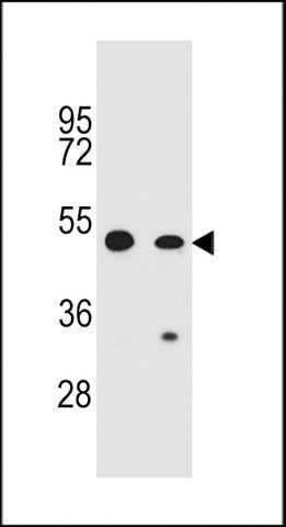ANTI-COP1(N-TERMINAL) antibody produced in rabbit