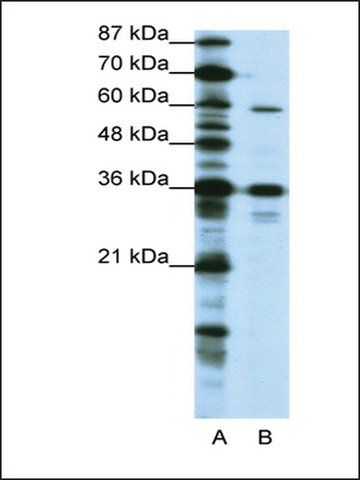 Anti-CREB3L1 (AB2) antibody produced in rabbit