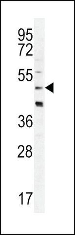 ANTI-CRFR2D antibody produced in rabbit